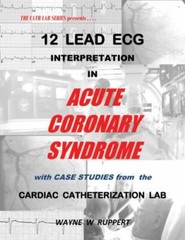 12 Lead ECG Interpretation in Acute Coronary Syndrome with Case Studies from the