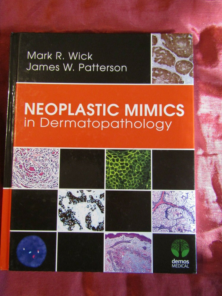 Neoplastic Mimics in Dermatopathology by James W. Patterson (English) Hardcover