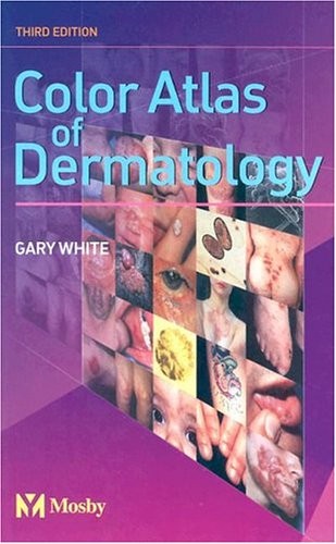 Color Atlas of Dermatology – paperback White MD, Gary M.