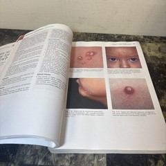 Urgent Care Dermatology: Symptom-Based Diagnosis by Whitney A. High and James E