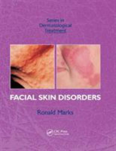 Facial Skin Disorders, Paperback by Marks, Ronald, Like New Used, Free shippi…