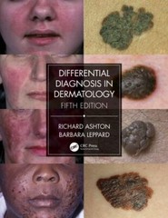 Differential Diagnosis in Dermatology, Paperback by Ashton, Richard; Leppard,…