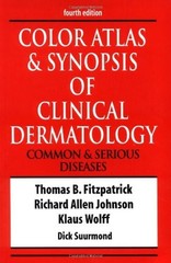 Color Atlas & Synopsis of Clinical Dermatology – paperback Fitzpatrick, Thom…