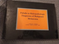 Pitfalls in Histopathologic Diagnosis of Malignant Melanoma A B Ackerman
