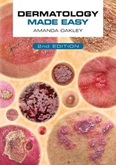 Dermatology Made Easy, second edition 2nd Edition by Amanda Oakley Paperback Boo