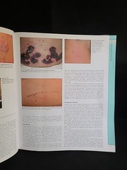 Dermatology Vol 1 Third Edition Bolognia Jorizzo Schaffer HC 2012