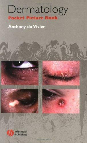 Dermatology Pocket Picture Book