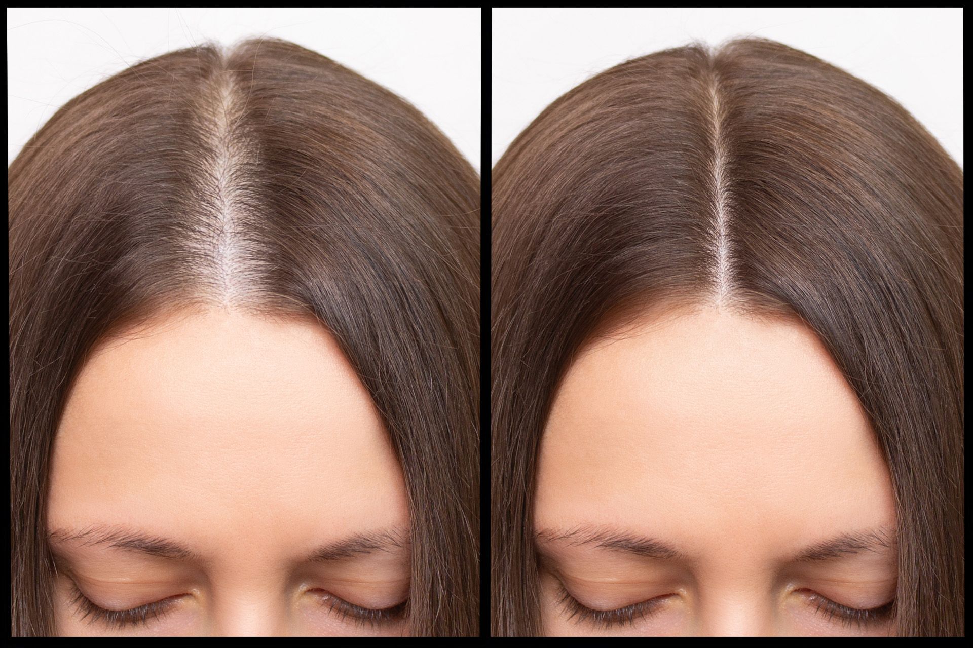 Side-by-side close-up of brown hair parting with a visible lighter scalp line.