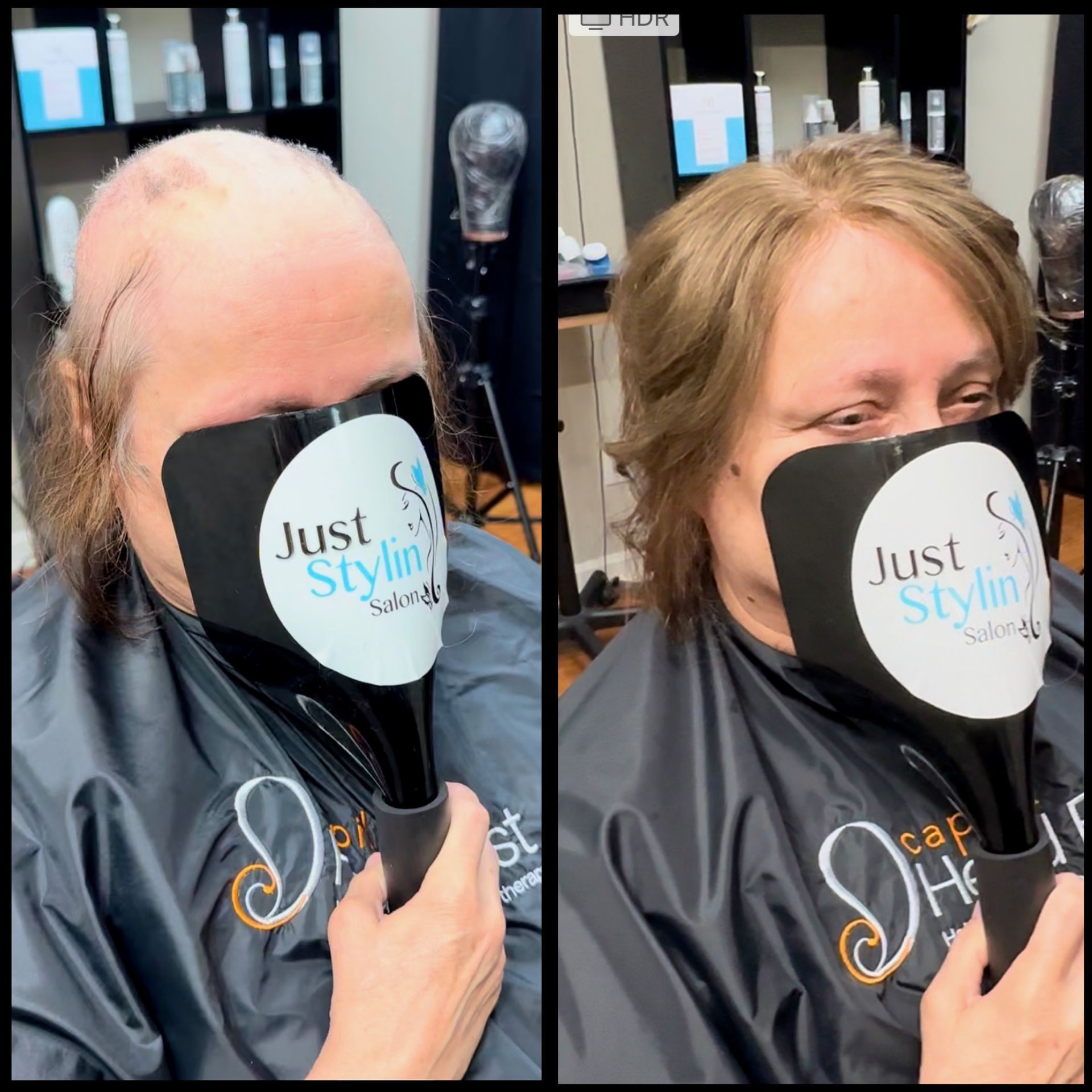 Side-by-side salon before-and-after: balding hairline on left, fuller blond hairstyle on right, both with face masks