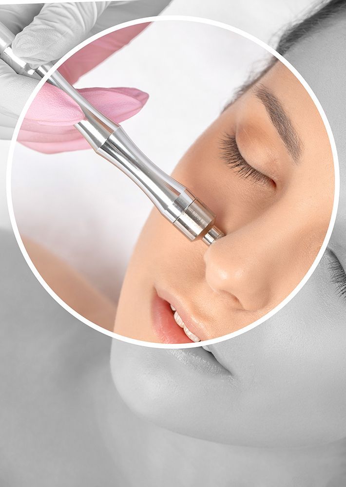 Cosmetic procedure with a handheld device applied to a woman’s nose and cheek, shown in a circular close-up.
