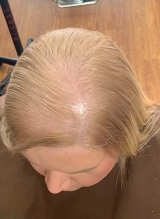 Top-down view of a person with blonde hair and a visible thinning part indoors.